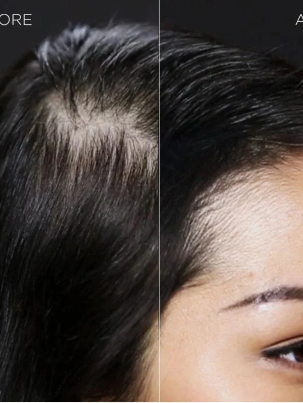 2 Toppik hair fiber (Dark Brown)...Limited Time Sale